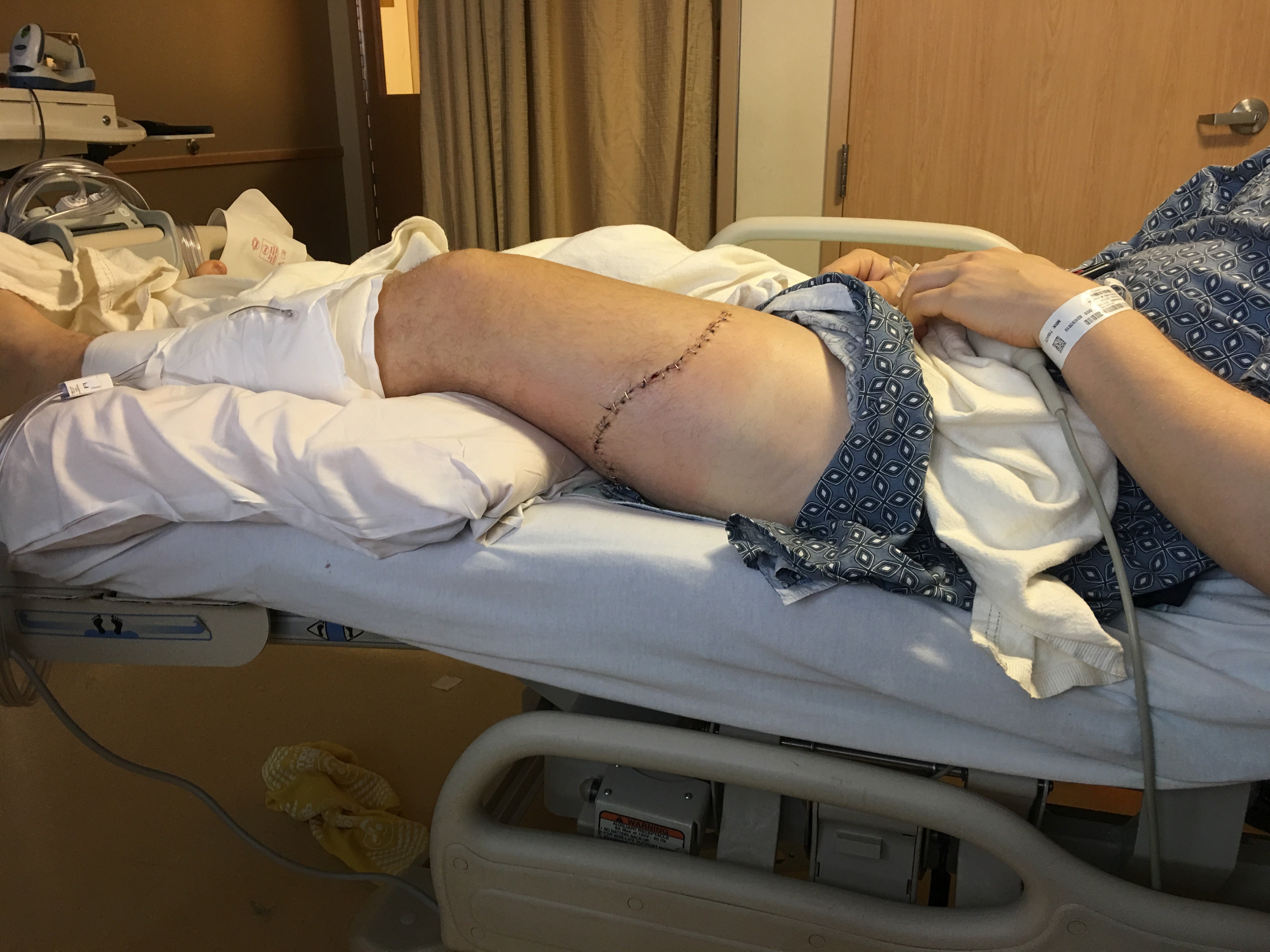 Victor Wiacek in convalescenza in ospedale dopo l'incidente sugli sci